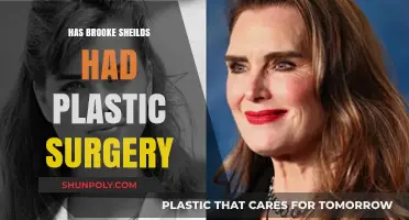 Brooke Shields Plastic Surgery: Fact-Checking the Rumors and Speculations