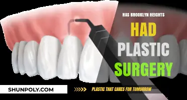 Brooklyn Heights Plastic Surgery Rumors: Fact or Fiction?