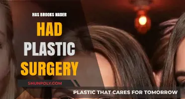 Has Brooks Nader Had Plastic Surgery? Unveiling the Truth