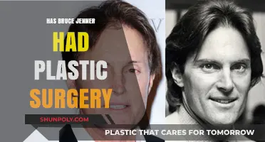 Bruce Jenner's Transformation: Plastic Surgery Speculations and Truths Revealed