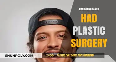 Has Bruno Mars Had Plastic Surgery? Unveiling the Truth
