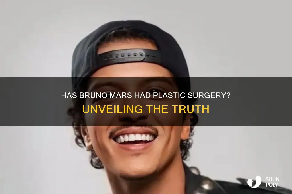 has bruno mars had plastic surgery