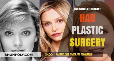Calista Flockhart's Transformation: Plastic Surgery Rumors Explored