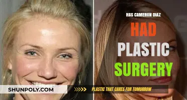 Cameron Diaz Plastic Surgery: Fact-Checking Rumors and Speculations