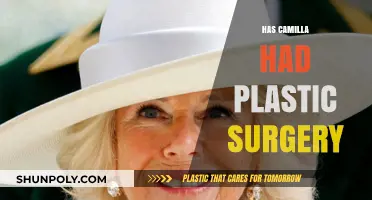 Camilla's Transformation: Unveiling the Truth About Her Plastic Surgery Rumors