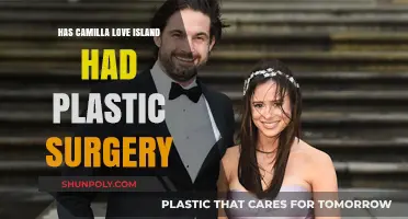 Camilla Love Island Plastic Surgery: Fact-Checking Her Transformation