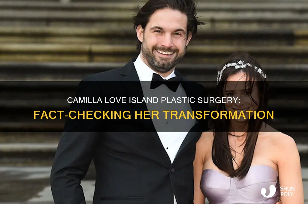 has camilla love island had plastic surgery
