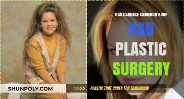 Candace Cameron Bure's Transformation: Plastic Surgery Rumors Explored
