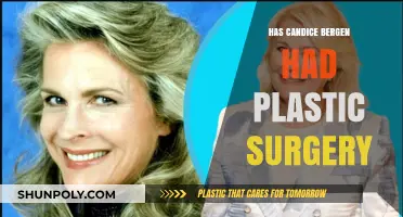 Candice Bergen's Transformation: Plastic Surgery Rumors Explored