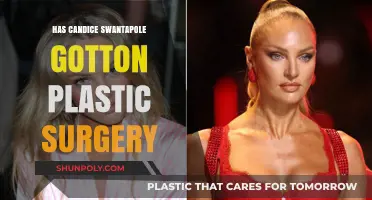 Candice Swanepoel's Transformation: Plastic Surgery Rumors Explored