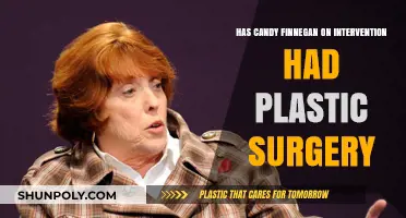 Candy Finnigan's Transformation: Plastic Surgery Speculations on Intervention