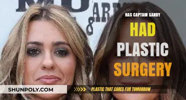 Captain Sandy's Transformation: Plastic Surgery Speculations and Truths Revealed
