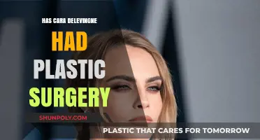 Cara Delevingne's Transformation: Plastic Surgery Speculations and Facts Revealed