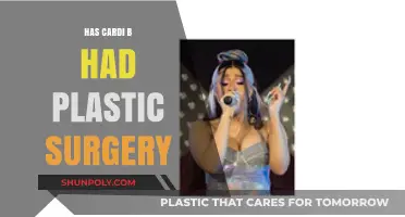 Cardi B's Transformation: Plastic Surgery Rumors and Reality Revealed