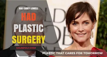 Carey Lowell's Appearance: Plastic Surgery Speculations and Truths