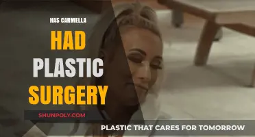 Carmella's Transformation: Plastic Surgery Rumors and the Truth Behind Them