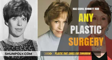 Carol Burnett's Transformation: Plastic Surgery Speculations and Truths Revealed