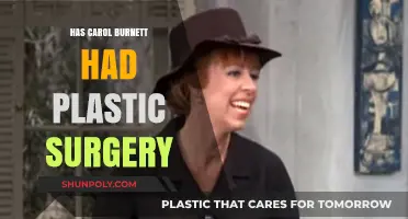 Carol Burnett's Transformation: Plastic Surgery Speculations and Truths Revealed