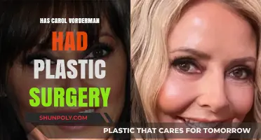 Carol Vorderman Plastic Surgery: Fact-Checking the Rumors and Speculations