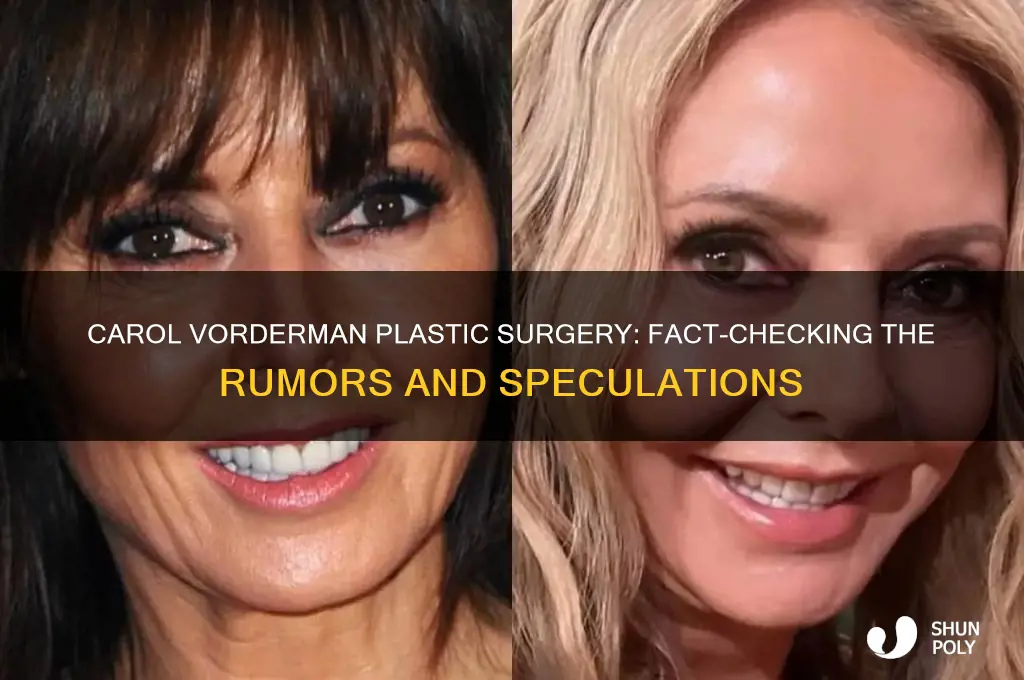 has carol vorderman had plastic surgery