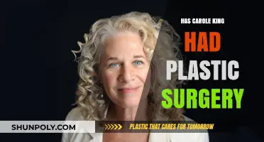 Carole King's Ageless Look: Plastic Surgery Speculations Explored