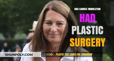Carole Middleton's Youthful Look: Plastic Surgery Speculations Explored