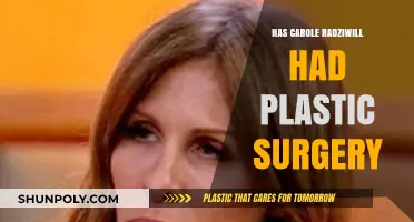 Carole Radziwill's Transformation: Plastic Surgery Speculations and Truths