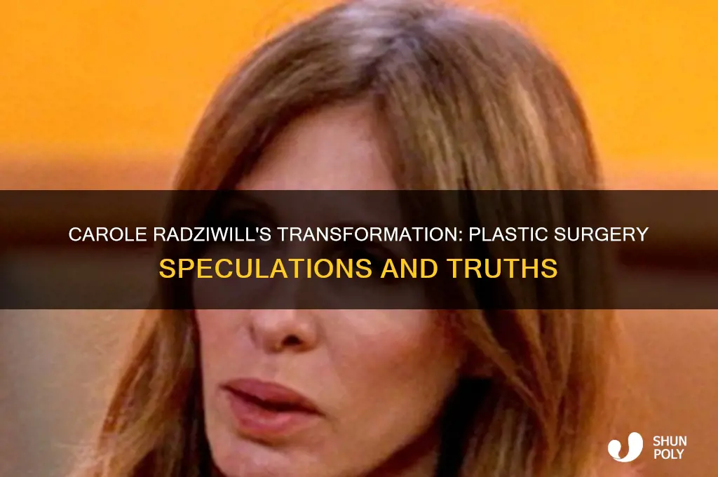 has carole radziwill had plastic surgery