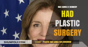 Carolie Kennedy Plastic Surgery: Fact-Checking the Rumors and Speculations