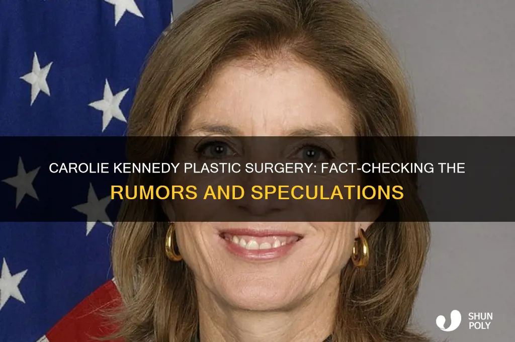 has caroli e kennedy had plastic surgery