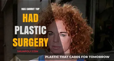 Carrot Top Plastic Surgery: Fact-Checking the Comedian's Transformation