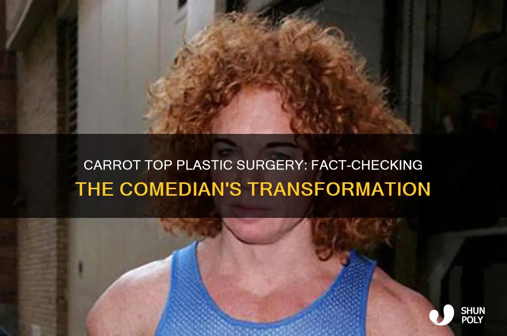 has carrot top had plastic surgery
