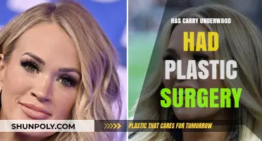Has Carrie Underwood Had Plastic Surgery? Unveiling the Truth