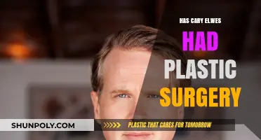Cary Elwes Plastic Surgery: Fact-Checking the Rumors and Speculations