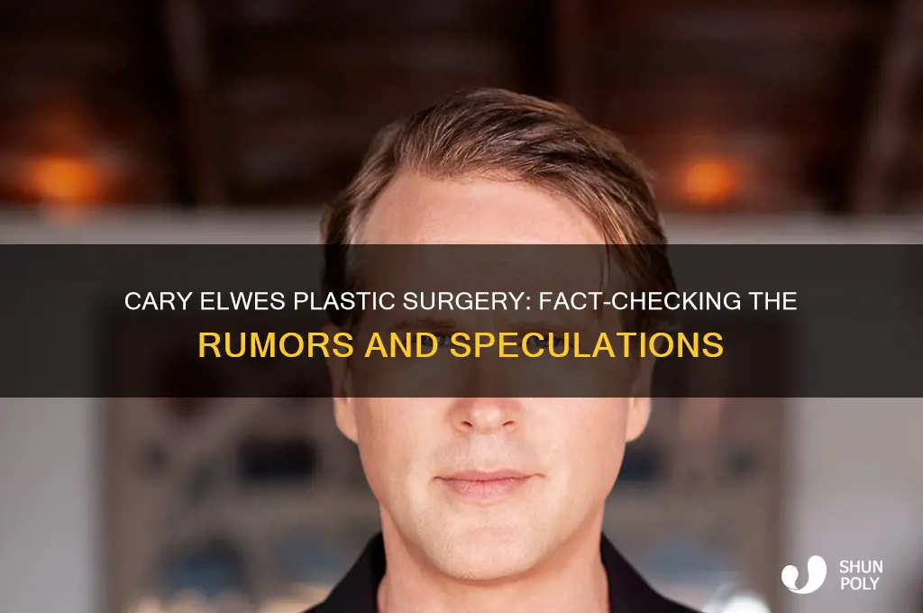 has cary elwes had plastic surgery