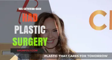 Catherine Bach's Transformation: Plastic Surgery Rumors and Speculations