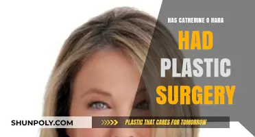 Catherine O'Hara's Ageless Beauty: Plastic Surgery Speculations Explored