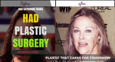 Catherine O'Hara's Transformation: Plastic Surgery Rumors Explored