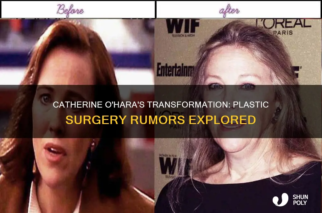 has catherine ohara had plastic surgery