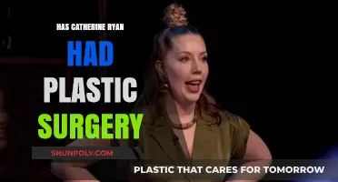Catherine Ryan's Transformation: Plastic Surgery Speculations and Truths