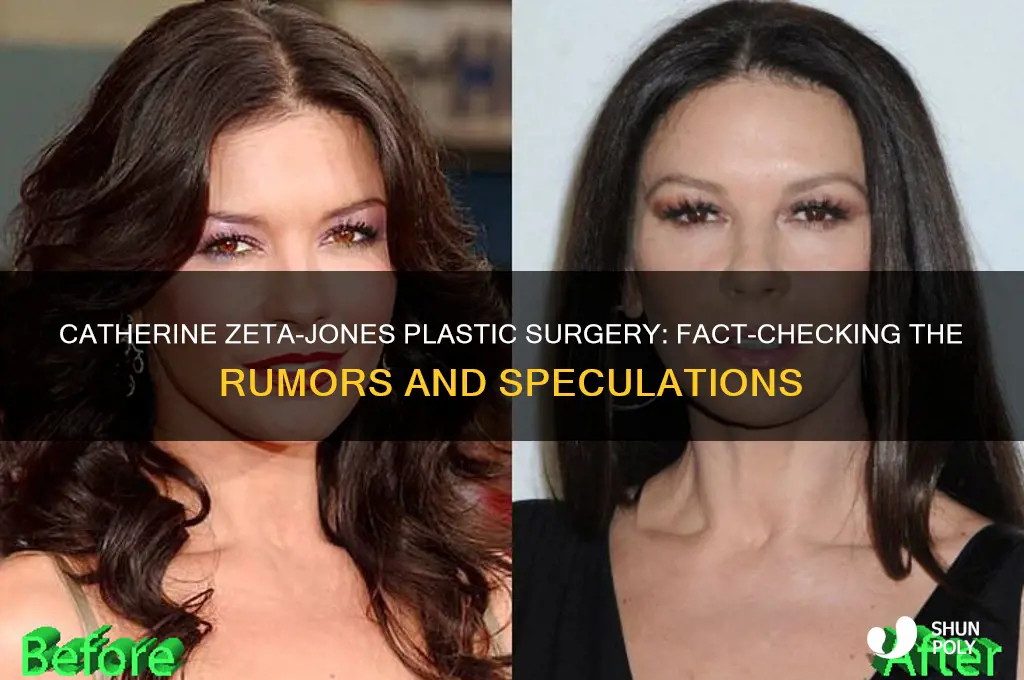 has catherine zeta jones had plastic surgery