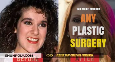 Celine Dion's Transformation: Plastic Surgery Rumors and Reality Revealed