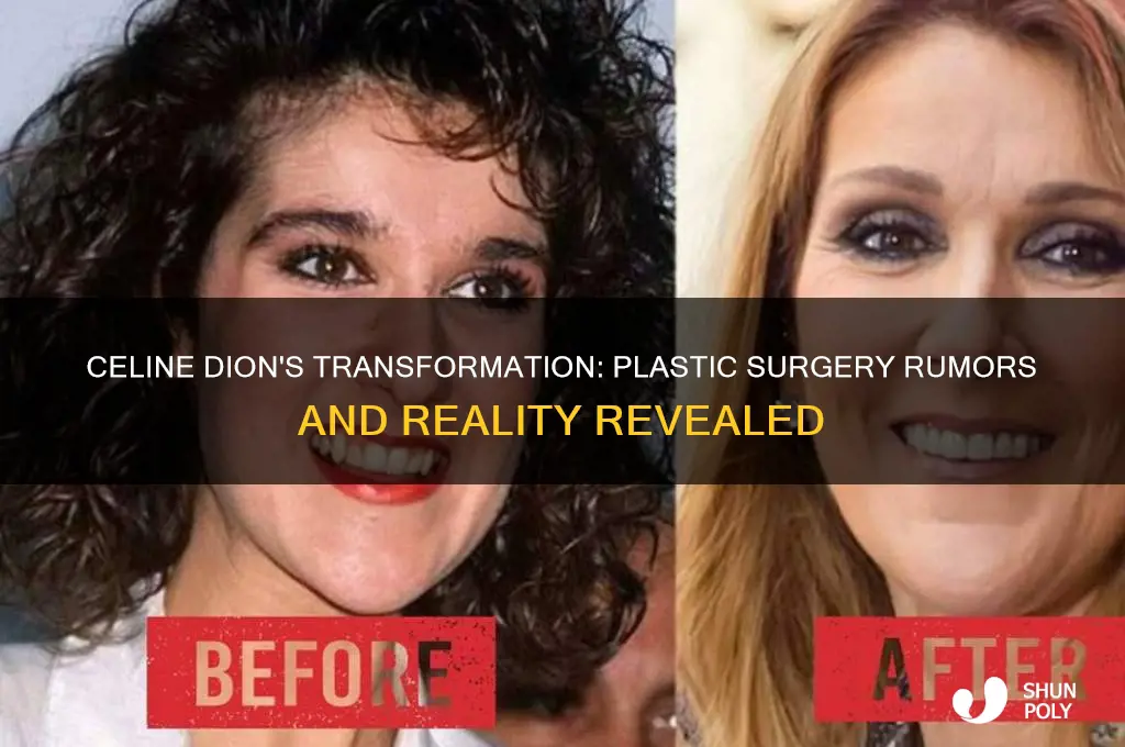has celine dion had any plastic surgery