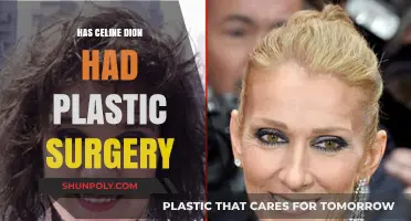 Celine Dion's Transformation: Plastic Surgery Rumors and Speculations