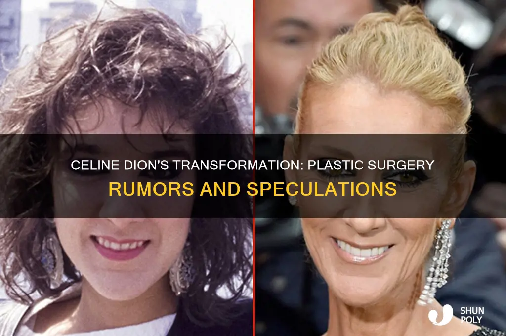 has celine dion had plastic surgery