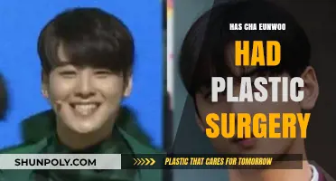 Cha Eunwoo's Transformation: Natural Beauty or Plastic Surgery?