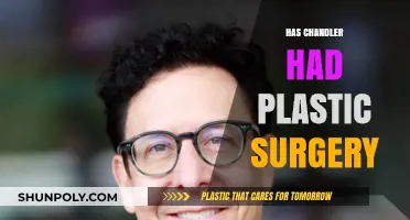 Chandler's Transformation: Unveiling the Truth About Plastic Surgery Speculations