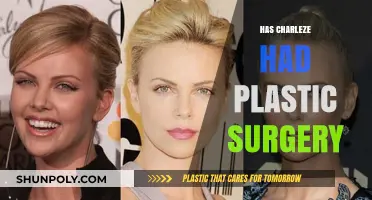 Charlize Theron's Transformation: Plastic Surgery Rumors and Reality Revealed