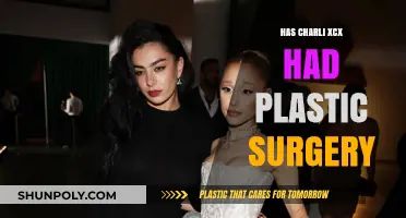 Charli XCX Plastic Surgery Speculations: Fact-Checking the Rumors