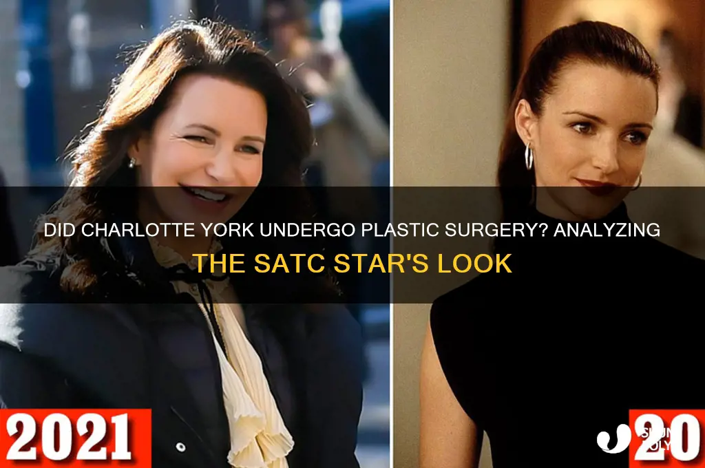 has charlotte from sex and the city had plastic surgery